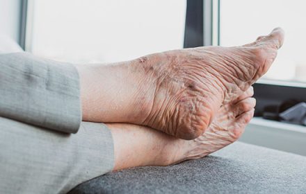 geriatricarea-cuidado-pies